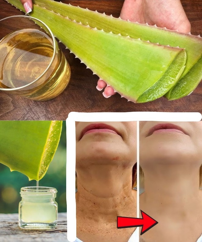 1000 razy skuteczniejszy niż botoks! Naturalny kolagen z aloesem!