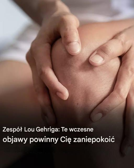 Zespół Lou Gehriga: Oto pierwsze objawy tej choroby